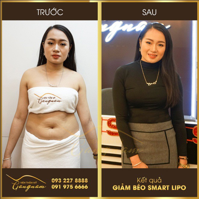 “dat len ban can” nhung phuong phap giam beo duoc quan tam nhieu nhat - 4