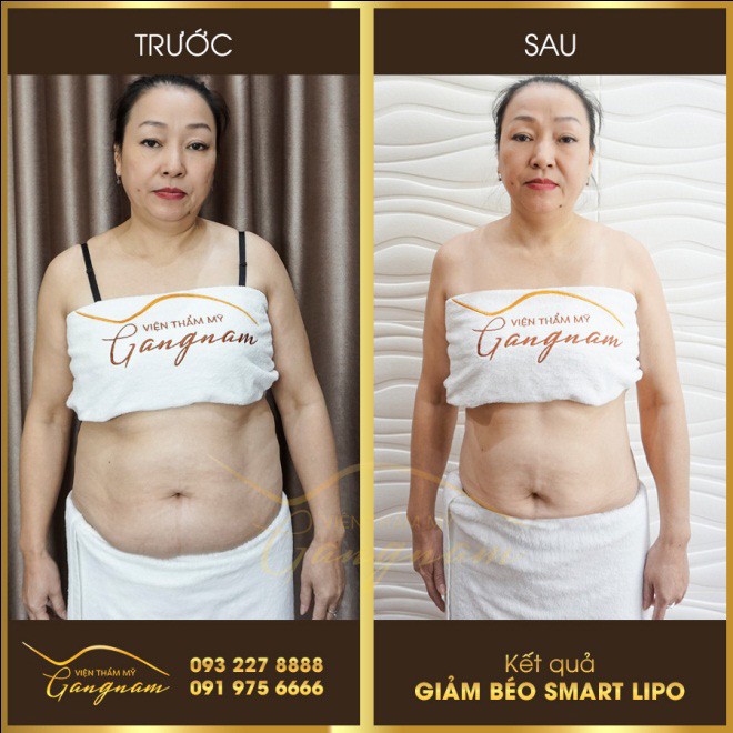 “dat len ban can” nhung phuong phap giam beo duoc quan tam nhieu nhat - 5