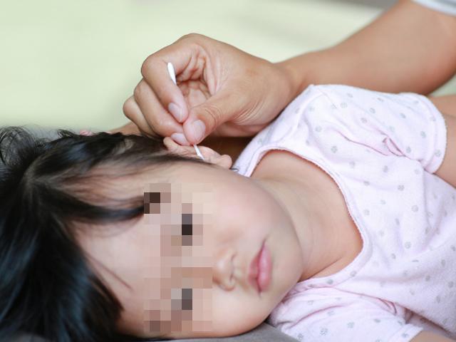 Bé gái bị nhiễm trùng tai, thủng màng nhĩ do mẹ chủ quan nghĩ con không sao
