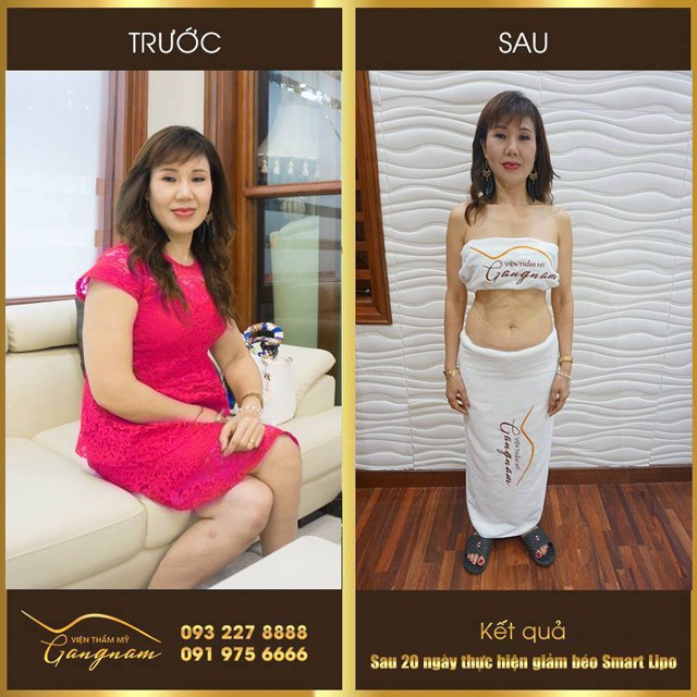 3 dieu tuong khong sai ma “sai khong tuong” ve giam can - 5