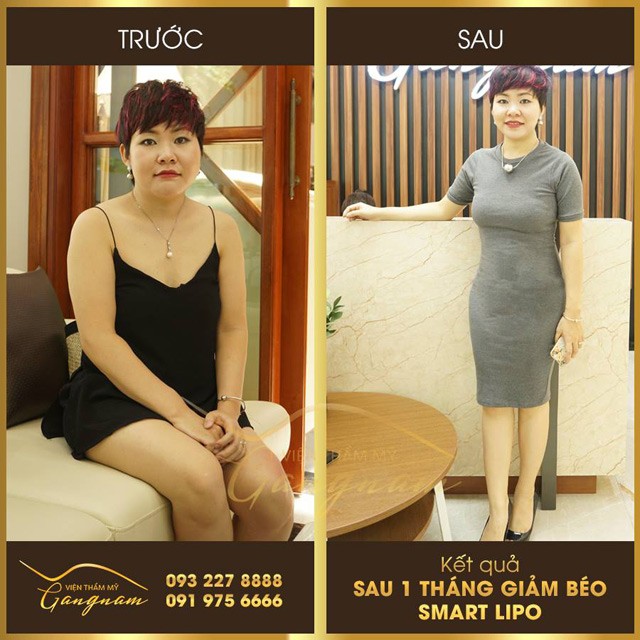 3 dieu tuong khong sai ma “sai khong tuong” ve giam can - 6