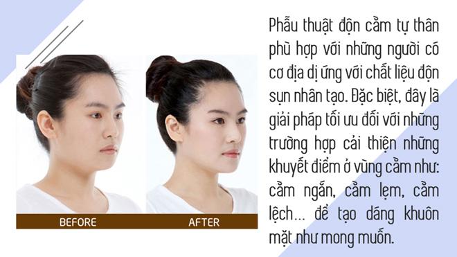 het got den don bang silicon, gio day chi em tim den phuong phap “truot” voi chinh cam cua minh! - 14