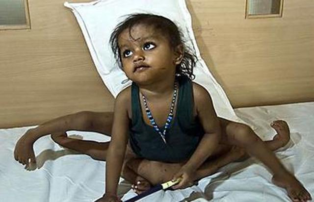 hoi chung ky la bien hai anh em ruot thanh "ma ca rong", khong the di ra troi nang - 1