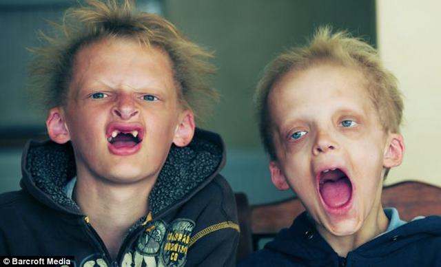 hoi chung ky la bien hai anh em ruot thanh "ma ca rong", khong the di ra troi nang - 2