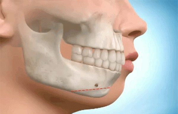 het got den don bang silicon, gio day chi em tim den phuong phap “truot” voi chinh cam cua minh! - 8