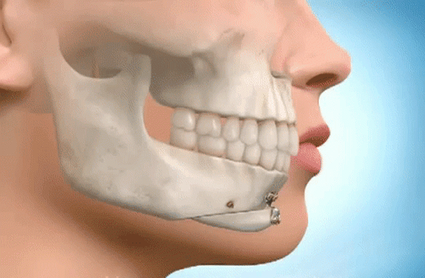 het got den don bang silicon, gio day chi em tim den phuong phap “truot” voi chinh cam cua minh! - 12