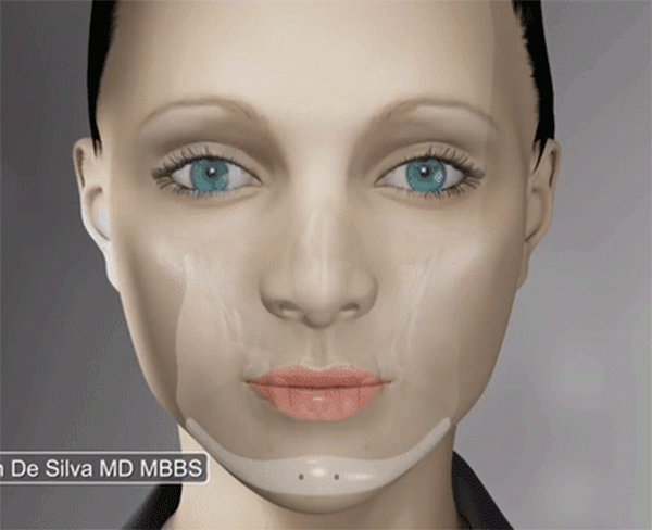 het got den don bang silicon, gio day chi em tim den phuong phap “truot” voi chinh cam cua minh! - 6