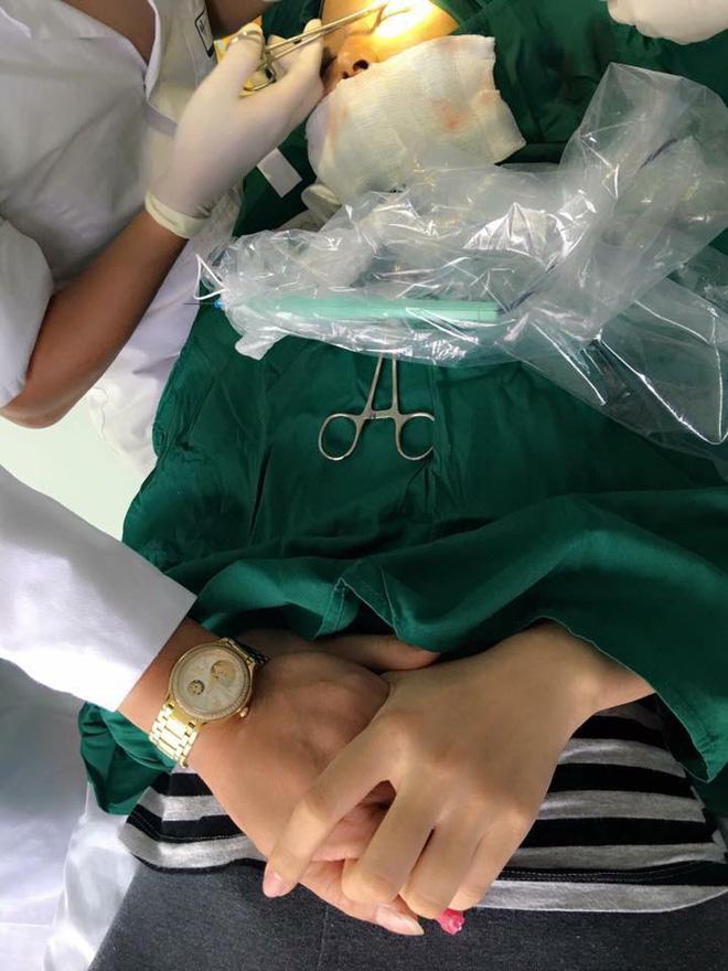bi ban che xau, me tre ha thanh quyet tam "lot xac" nho phau thuat khien chong vui ra mat! - 4