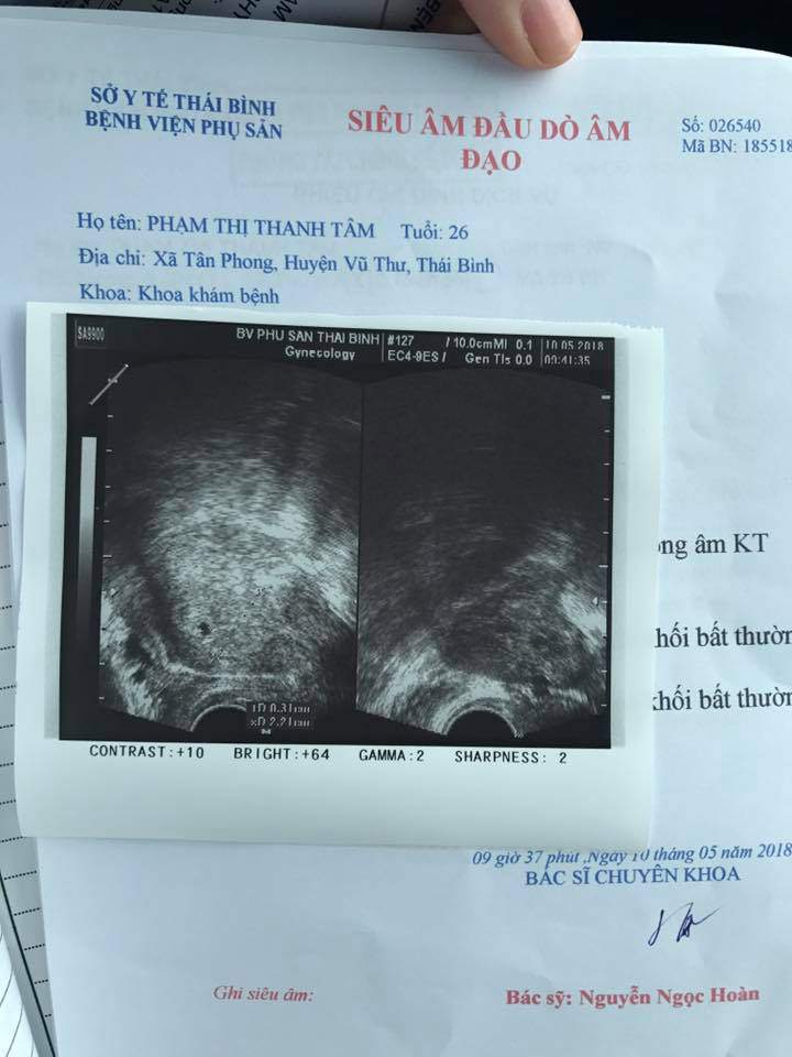 canh mang bau vat va cua tieu thu 9x nhan nuoi be yen nhi: ngay tiem 4 mui giu thai - 3