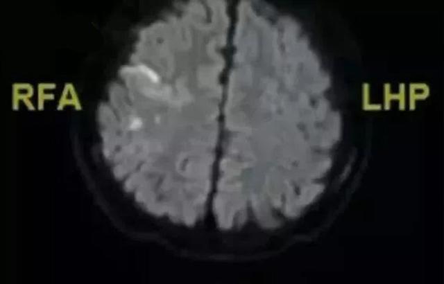 be 14 tuoi bi nhoi mau nao, liet nua nguoi, nguyen nhan khien nguoi lon, tre nho deu phai so - 2