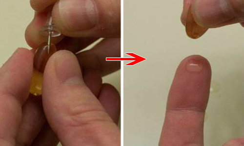 chay ra cho mua nam rau ma ve xay nhuyen roi dap len mat, seo lom den may cung khoi - 11