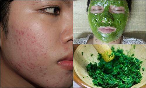 chay ra cho mua nam rau ma ve xay nhuyen roi dap len mat, seo lom den may cung khoi - 5