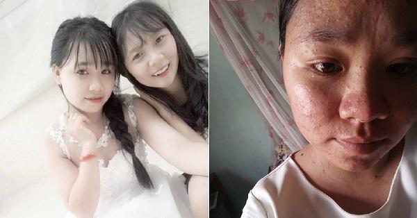 loat anh truoc - sau khi mang bau chung minh phu nu lay chong lai moi dua con la that - 8