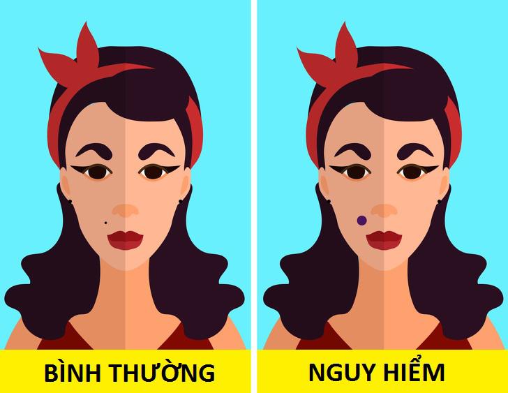 8 trieu chung bat thuong tren co the chi em dung "nham mat lam ngo" keo hoi khong kip - 7
