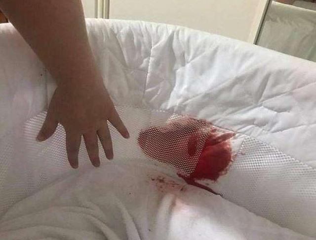 thay noi cua con dinh day mau, me bang hoang phat hien con bi thuong vi thu khong tuong - 2