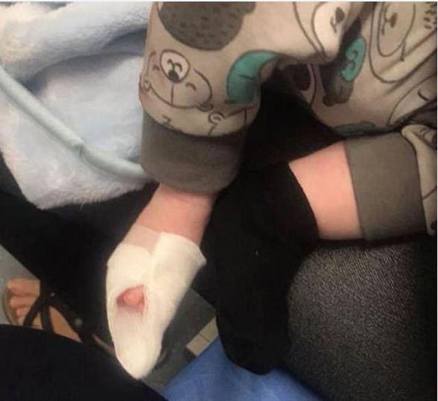 thay noi cua con dinh day mau, me bang hoang phat hien con bi thuong vi thu khong tuong - 4