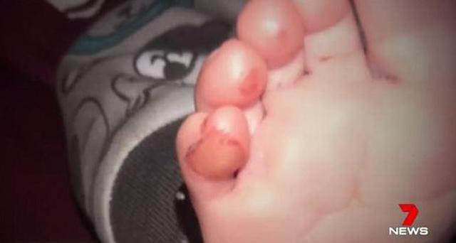 thay noi cua con dinh day mau, me bang hoang phat hien con bi thuong vi thu khong tuong - 3