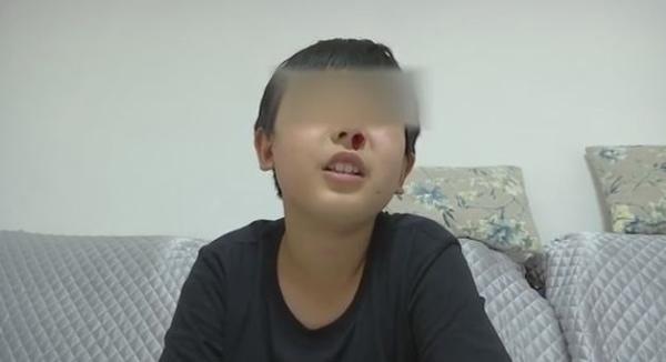 cau be chay mau cam 20 lan mot ngay moi khi hoc bai, ngay ca bac si cung "bo tay" - 1