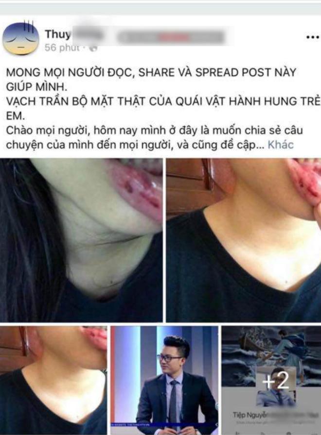 nu sinh to anh re btv bao hanh: chuyen thuy d bi danh nhom ban than da biet tu lau - 1