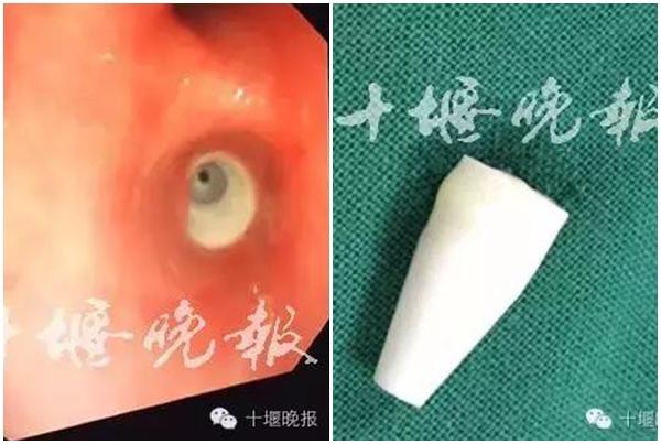 dang trong lop, cau be 9 tuoi chi kip noi mot cau roi ngat, nguyen nhan tu thu quen thuoc - 2