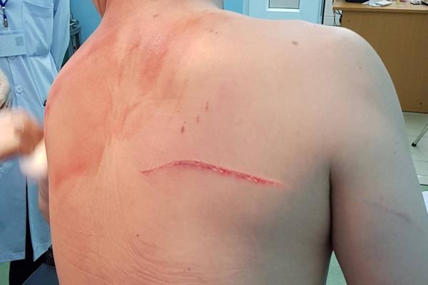 nhung xich mich ly ky giua bac si chiem quóc thái va nguoi vo cu - 3