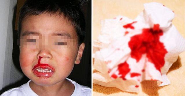 thay con chay mau cam, me tre lien lam dieu nay nhung ngay sau do hoi han tot cung - 1