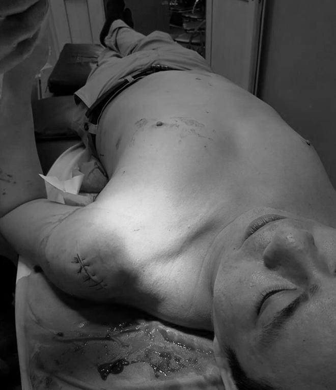 vo bac si chiem quoc thai khai gi ve hop dong tien ty thue giang ho chem chong? - 2