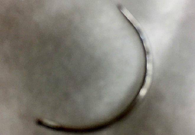 thong tin bat ngo vu bac si lam roi kim vao vung kin khien san phu chay mau o at - 1