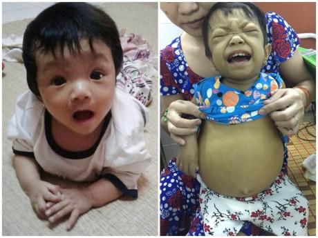 Tưởng tắm nắng chữa vàng da cho con sơ sinh, mẹ Việt rụng rời khi nghe bác sĩ kết luận