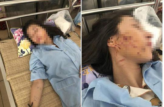 vu co gai bi lot sach do do nuoc mam, bot ot: co tin nhan qua lai - 2