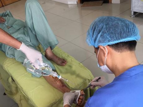 Tưởng mụn nước vô hại, không ngờ suýt tháo bỏ chân vì hoại tử