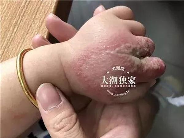 dua con ra cong vien choi, me "ta hoa" khi vai ngay sau mat con phong rop, mung mu - 2