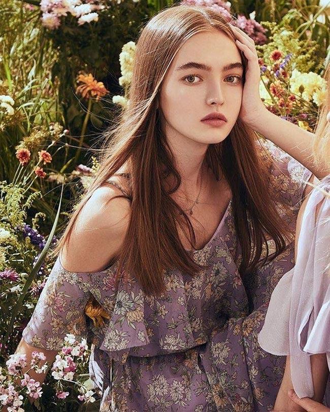 bat ngo voi su thay doi cua 3 mau nhi tung dep nhat the gioi ngay nao - 15