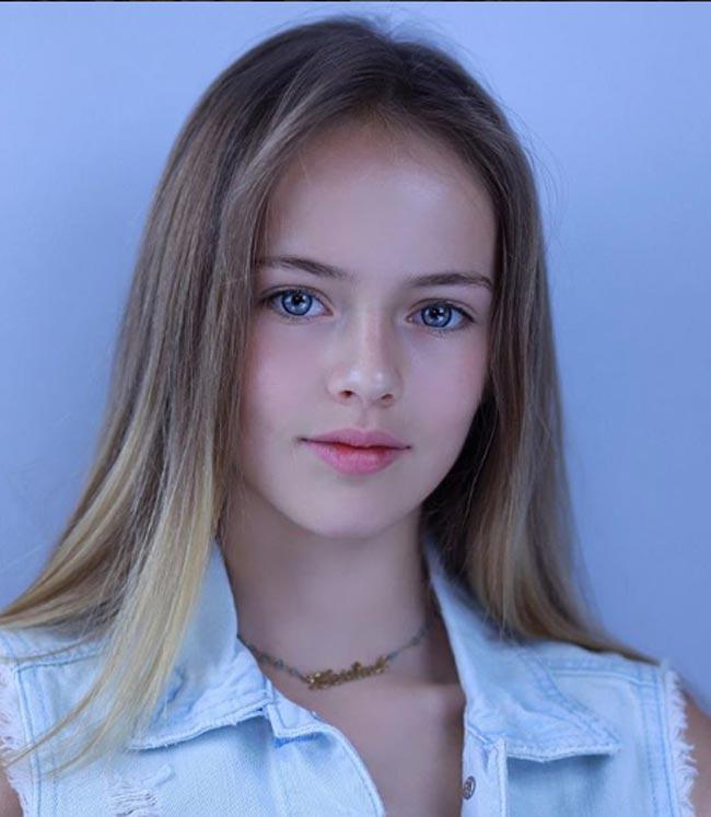 bat ngo voi su thay doi cua 3 mau nhi tung dep nhat the gioi ngay nao - 6