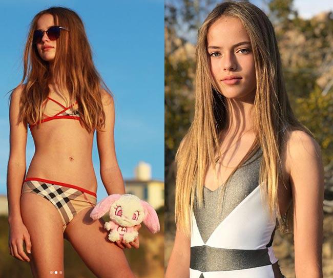 bat ngo voi su thay doi cua 3 mau nhi tung dep nhat the gioi ngay nao - 7