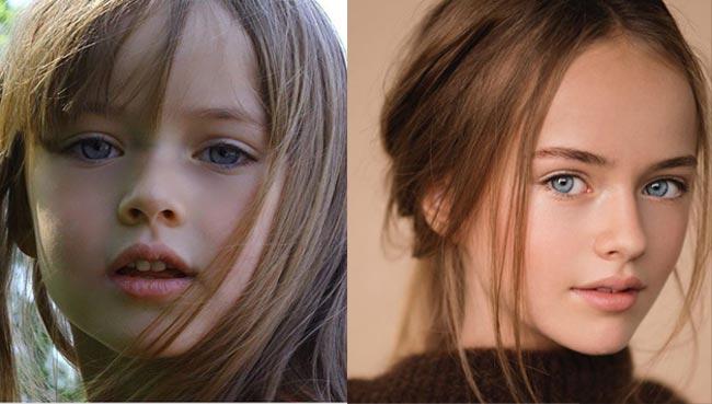 bat ngo voi su thay doi cua 3 mau nhi tung dep nhat the gioi ngay nao - 8