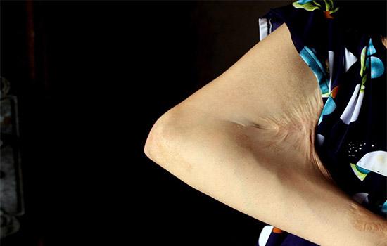 cau chuyen xuc dong phia sau buc anh nguoi me tre mang "guong mat quy" ngoi cho con an sua - 3