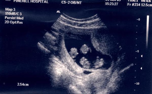 mong mai moi co con nhung ket qua lan dau kham thai khien cap doi "choang vang" - 3