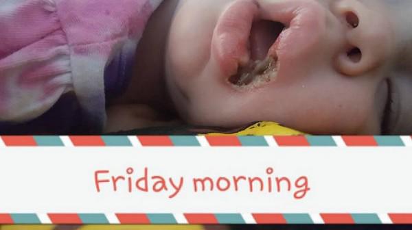 vua bo di, me phat dien thay con 8 thang tu vong vi soi day sac nha nao cung co - 4