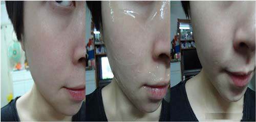 3 cach lam dep tu nha dam ngan ngua nep nhan, da kho cho phu nu u30, 40 - 4