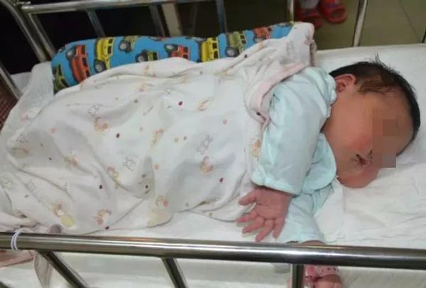 mang thai em be "khong lo", me suyt mat mang vi vo tu cung, con chui vao khoang bung - 1