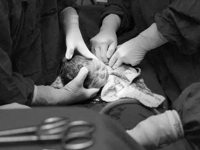 thai nhi 34 tuan: be lon bang qua dua vang - 5