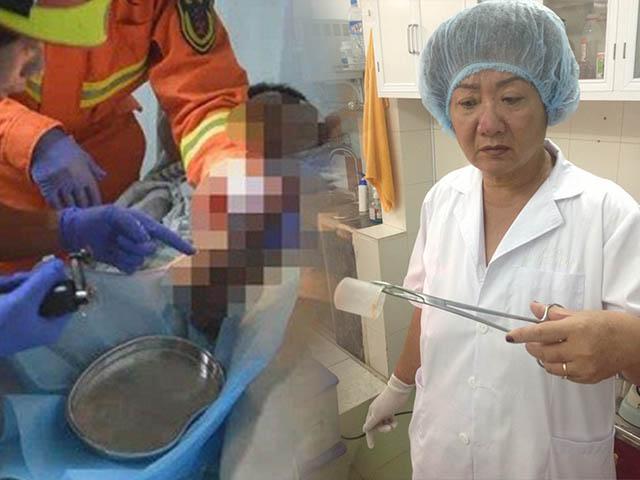 Thủ dâm với... cờ-lê và loạt tai nạn khóc dở mếu dở vì muốn thử cảm giác mới