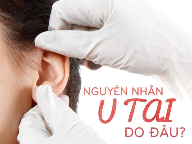 u tai - nguyen nhan do dau? - 1