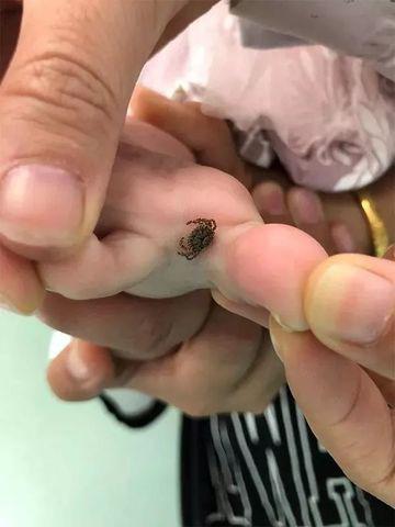 mot gia dinh co 2 nguoi chet do con trung can, canh bao loai cong trung nay rat de gap - 2