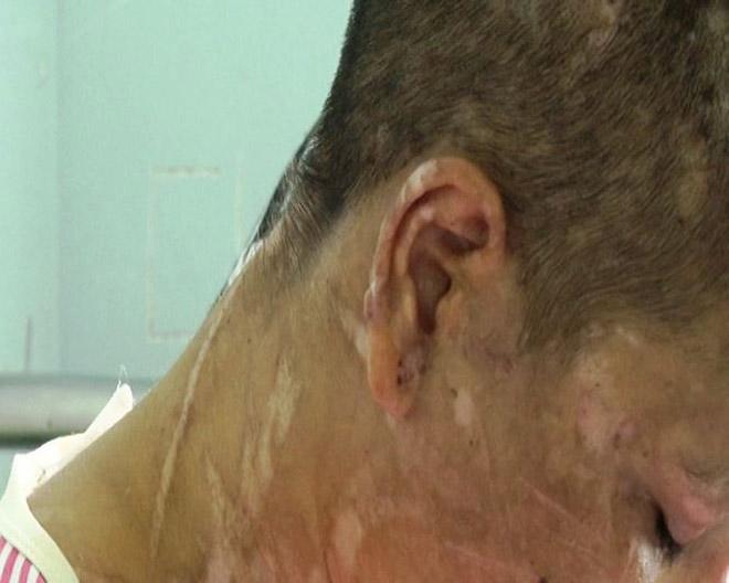 hang tram vet thuong tren nguoi nu giup viec bi chu nha tra tan nhu thoi trung co - 1