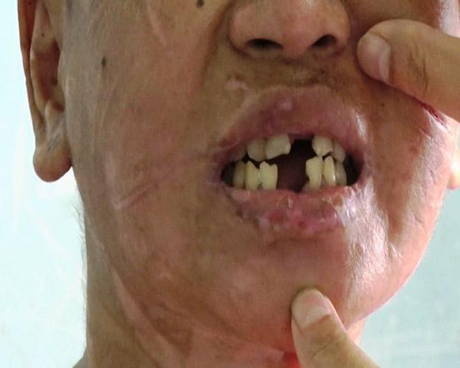 hang tram vet thuong tren nguoi nu giup viec bi chu nha tra tan nhu thoi trung co - 3