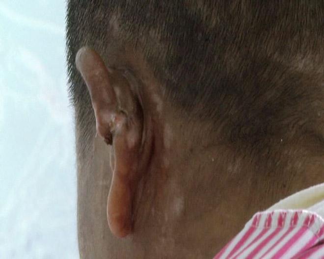 hang tram vet thuong tren nguoi nu giup viec bi chu nha tra tan nhu thoi trung co - 4