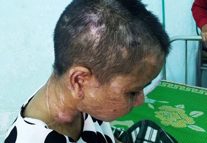 vu nu giup viec bi tra tan nhu thoi trung co: truy tim nghi can thu 2? - 1