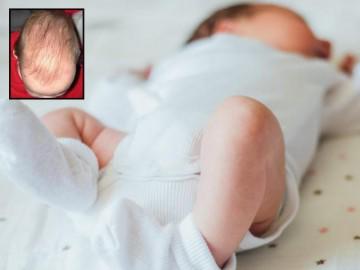 Bé 3 tháng thóp phồng to dẫn đến tử vong, BS lắc đầu "do mẹ sau sinh chỉ ăn thịt"